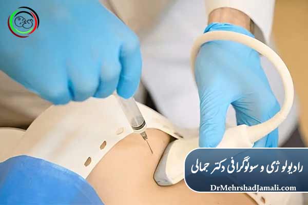 تخلیه کیست در مرکز ما
