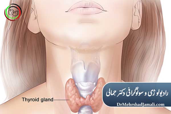 پیشگیری از کم‌کاری تیروئید