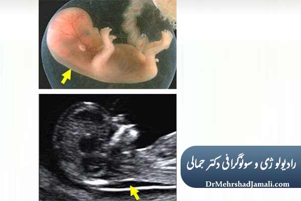 NT چه چیزی را نشان می‌دهد