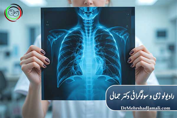 چه کسانی باید Chest X-Ray بدهند؟
