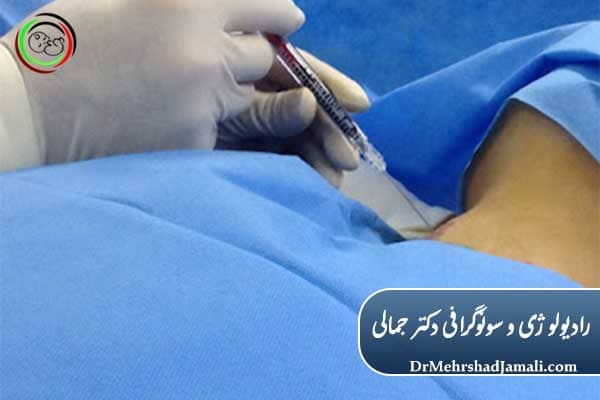 نحوه انجام تزریق ژل دیسک