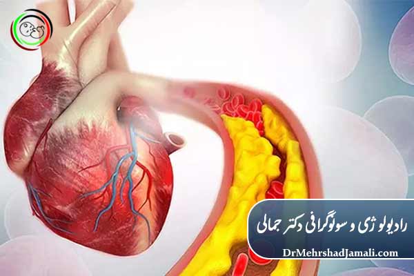 نقش تصویربرداری در تشخیص سکته قلبی