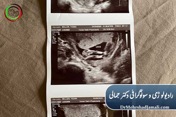 نحوه خواندن گزارش سونوگرافی بارداری