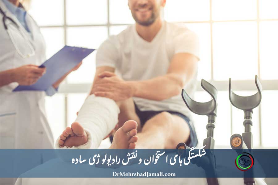 بررسی کامل شکستگی‌های استخوانی | شکستگی‌های استخوانی