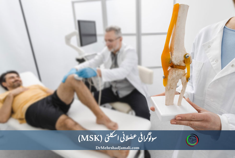 سونوگرافی عضلانی اسکلتی (MSK): روش دقیق برای بررسی دردهای عضلات