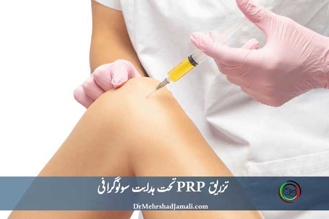 تزریق PRP تحت هدایت سونوگرافی