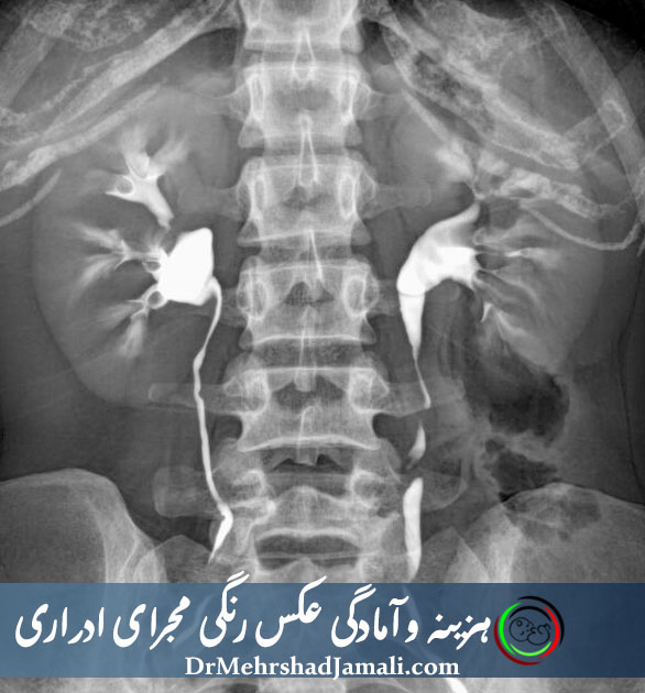عکس رنگی مجاری ادراری در تهران