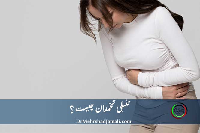تنبلی تخمدان چیست ؟ | راه درمان تنبلی تخمدان