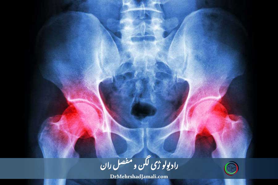 رادیولوژی لگن و مفصل ران در مرکز دکتر مهرشاد جمالی
