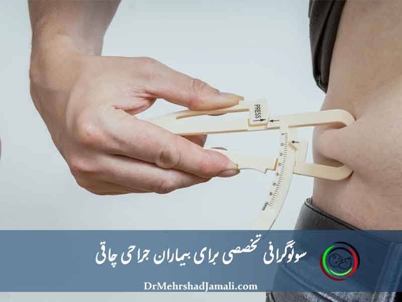 سونوگرافی تخصصی بیماران جراحی چاقی در مرکز دکتر مهرشاد جمالی