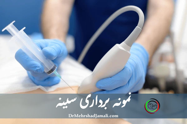 نمونه برداری سینه تهران