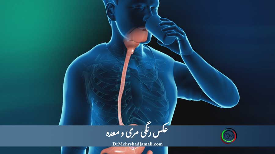 عکس رنگی مری و معده در مرکز تصویربرداری دکتر مهرشاد جمالی