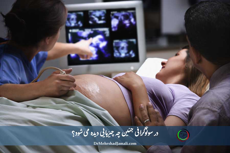 در سونوگرافی جنین چه چیزهایی دیده می‌شود؟