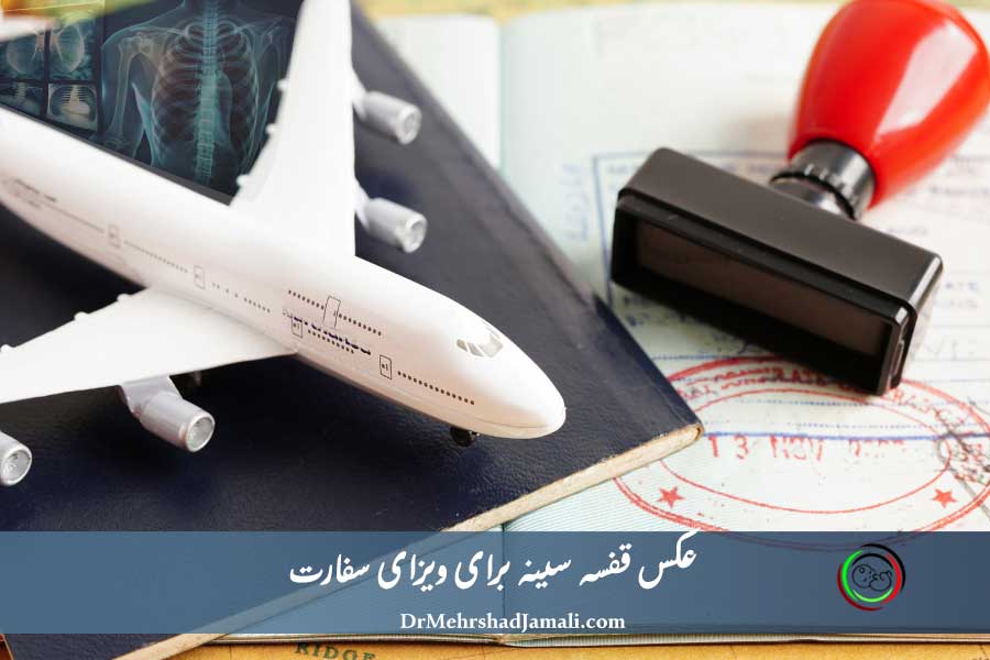 عکس قفسه سینه برای ویزا کانادا