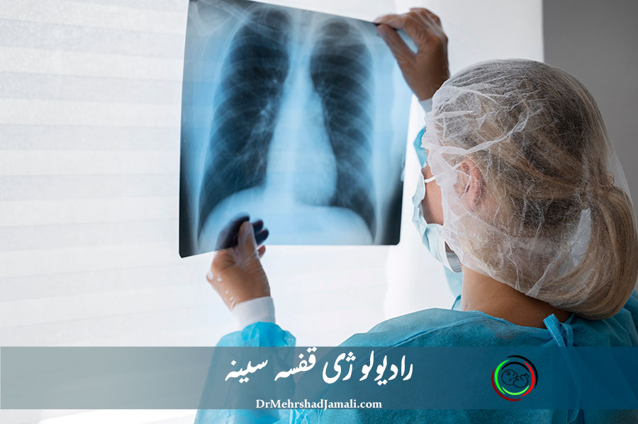عکس رادیولوژی قفسه سینه در تهران