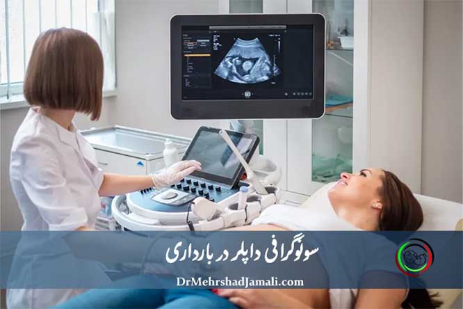 سونوگرافی داپلر در بارداری | بررسی جریان خون جنین + زمان انجام و نتایج