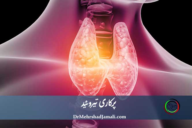پرکاری تیروئید