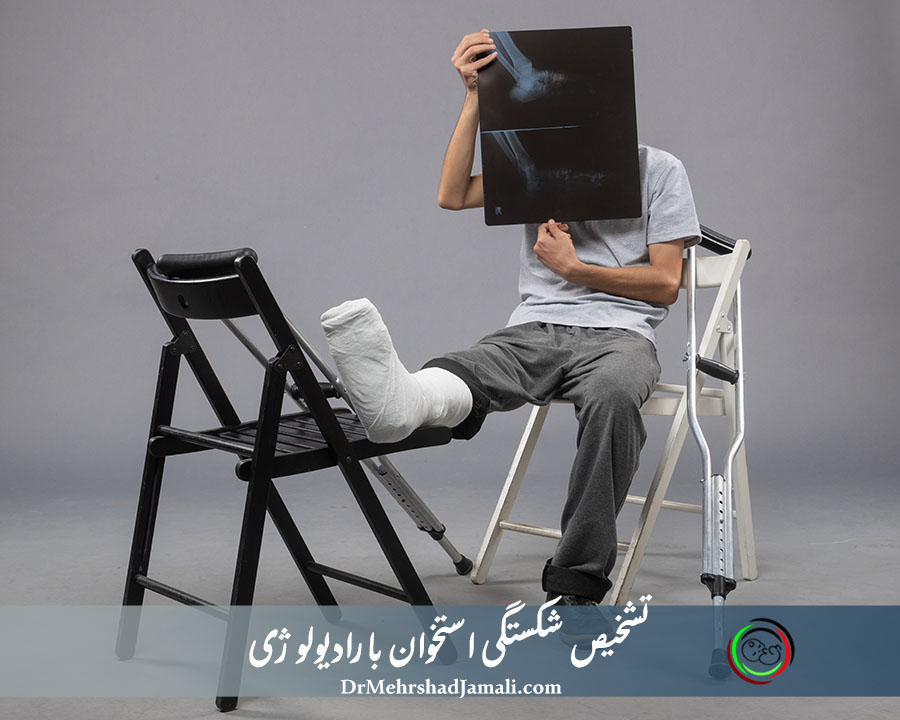 عکس رادیولوژی شکستگی استخوان در مرکز دکتر مهرشاد جمالی