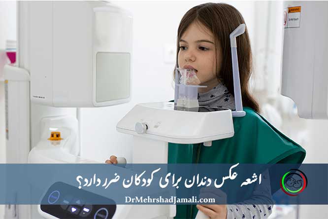 اشعه عکس دندان برای کودکان ضرر دارد؟ 