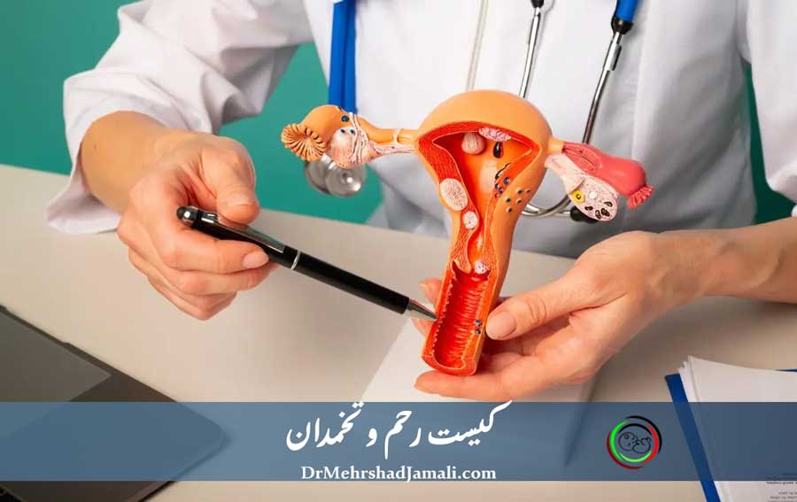 کیست تخمدان و رحم چیست؟ علائم، علت، سونوگرافی و درمان قطعی | مرکز دکتر مهرشاد جمالی
