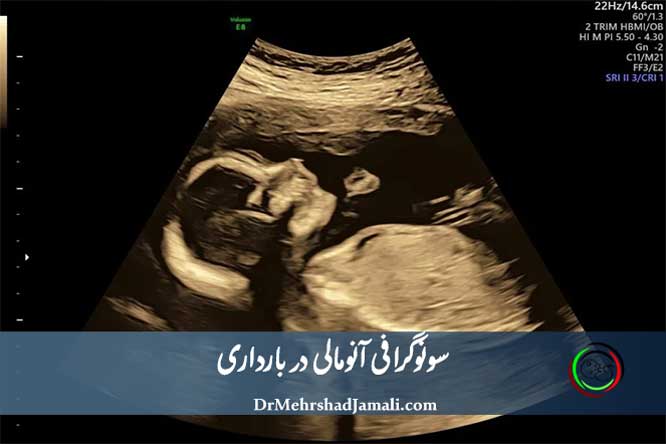 سونوگرافی آنومالی اسکن چیست و چه کاربرداری دارد ؟