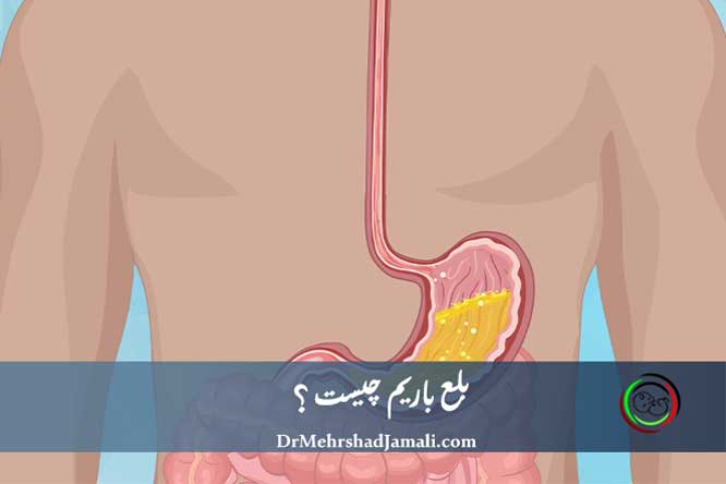 بلع باریم (Barium Swallow)