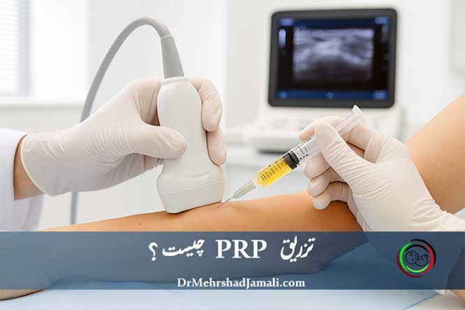 تزریق PRP چیست و چه کاربردی دارد ؟