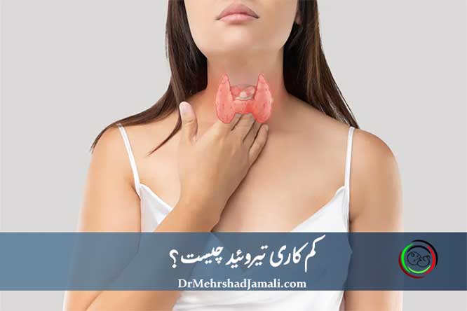 کم‌کاری تیروئید | علائم، علل، روش‌های تشخیص و بهترین درمان‌ها
