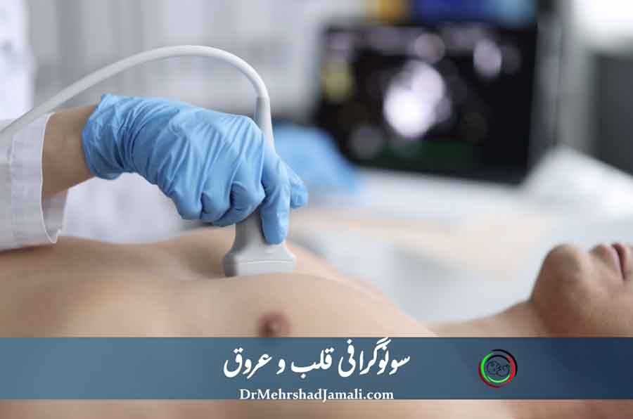 سونوگرافی قلب و عروق در تهران