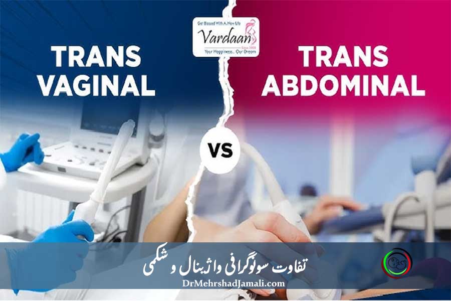 تفاوت سونوگرافی واژینال و شکمی