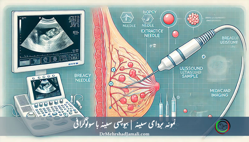 نمونه‌برداری سینه با سوزن بیوپسی تحت هدایت سونوگرافی در مرکز دکتر جمالی، بهترین مرکز بیوپسی سینه در تهران