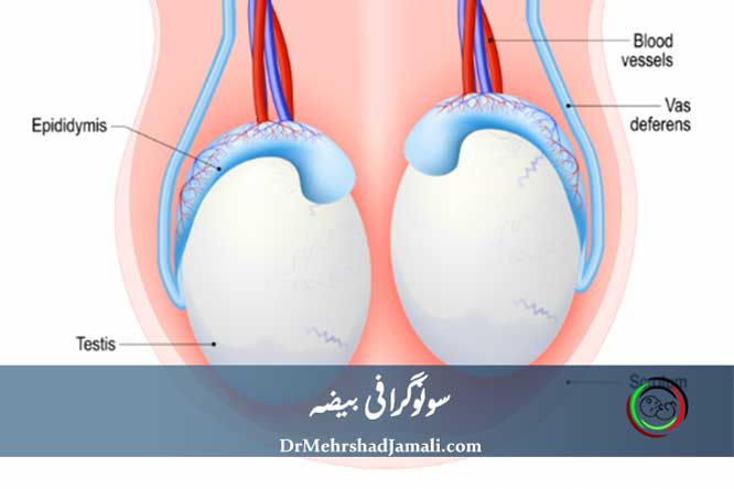 سونوگرافی بیضه 