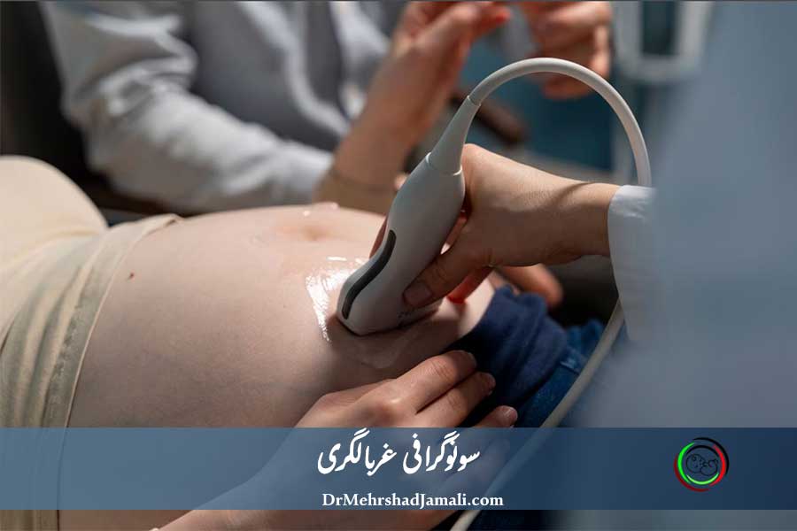 تصویری از سونوگرافی غربالگری جنین