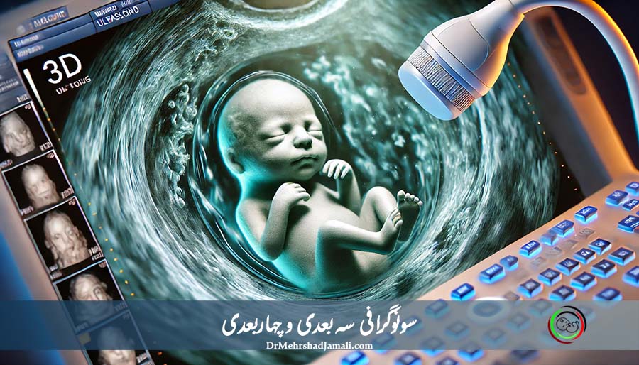 سونوگرافی سه‌ بعدی و چهار بعدی 