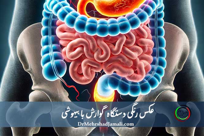 عکس رنگی دستگاه گوارش با بیهوشی