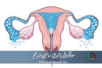 سونوگرافی رحم با تزریق سالین