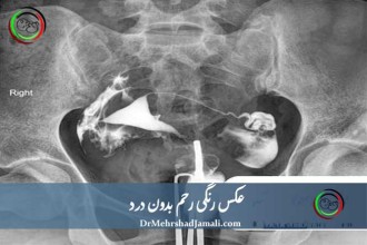 عکس رنگی رحم بدون درد در مرکز تصویربرداری دکتر مهرشاد جمالی