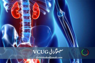 VCUG سیستوگرافی