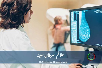 تشخیص علائم سرطان سینه