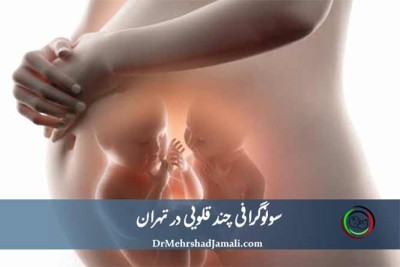 سونوگرافی چند قلویی در تهران