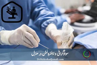 اینترونشن در منزل | اینترونشن در محل