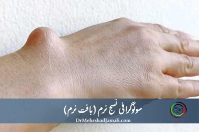 سونوگرافی بافت نرم | نسج نرم | دکتر مهرشاد جمالی