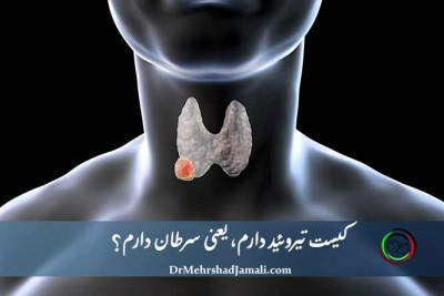 کیست تیروئید دارم یعنی سرطان دارم؟ پاسخ پزشکی