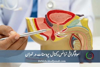 سونوگرافی ترانس رکتال پروستات تهران | پزشک متخصص + ۱۰٪ تخفیف