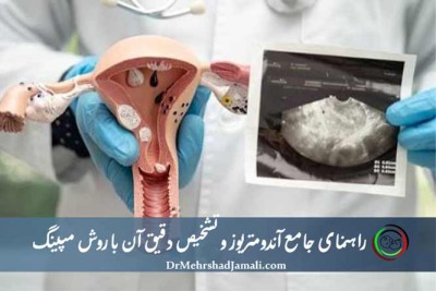 سونوگرافی مپینگ آندومتریوز با بالاترین دقت