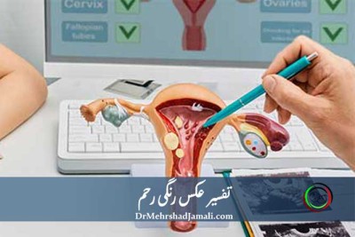 تفسیر عکس رنگی رحم (HSG)