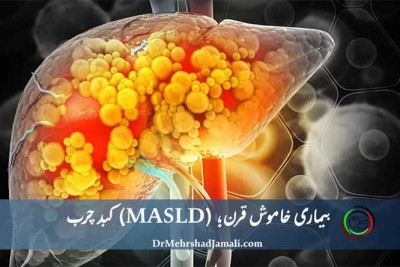 کبد چرب | تشخیص کبد چرب با سونوگرافی 