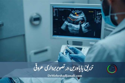 مرکز تخصصی تزریق پاپاورین تحت هدایت سونوگرافی در تهران