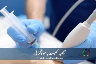 تخلیه کیست با سونوگرافی | مرکز دکتر مهرشاد جمالی