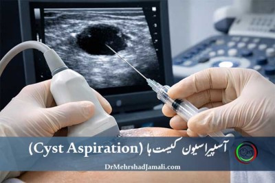 آسپیراسیون کیست تحت هدایت سونوگرافی در مرکز تصویربرداری دکتر مهرشاد جمالی